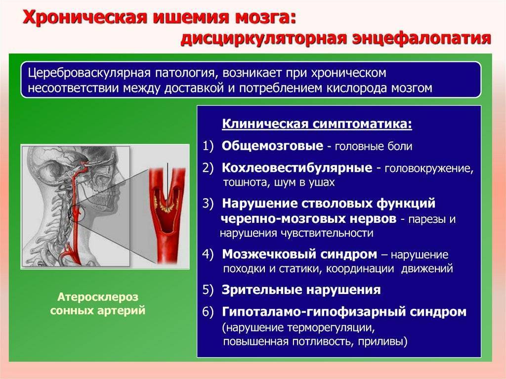 Степени поражения легких: кт1, кт2, кт3, кт4