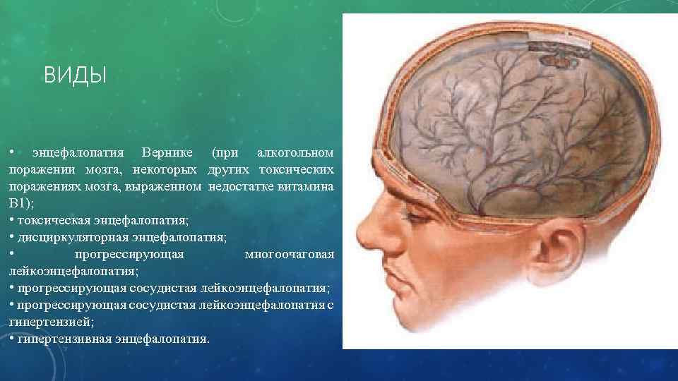 Энцефалопатия